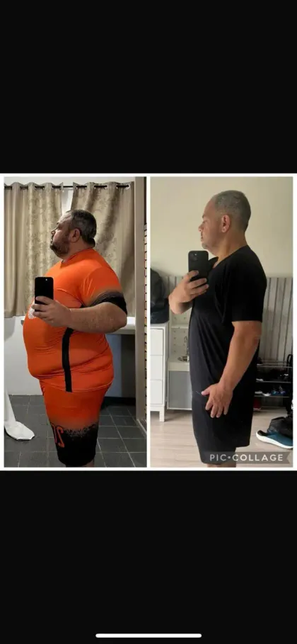 Resultado Método Goleiro 2.0